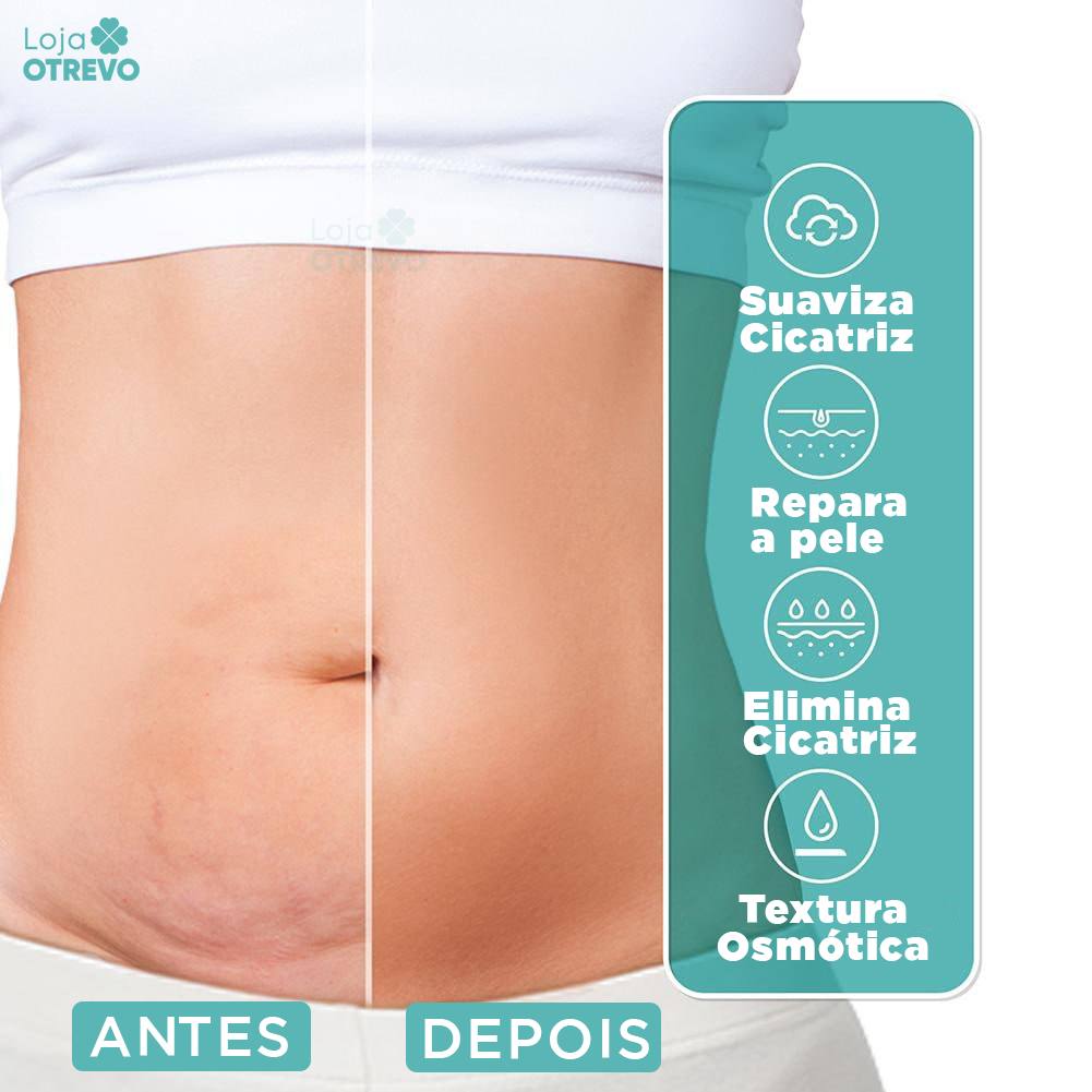 Spray Removedor Rápido de Cicatriz - ScarMax®