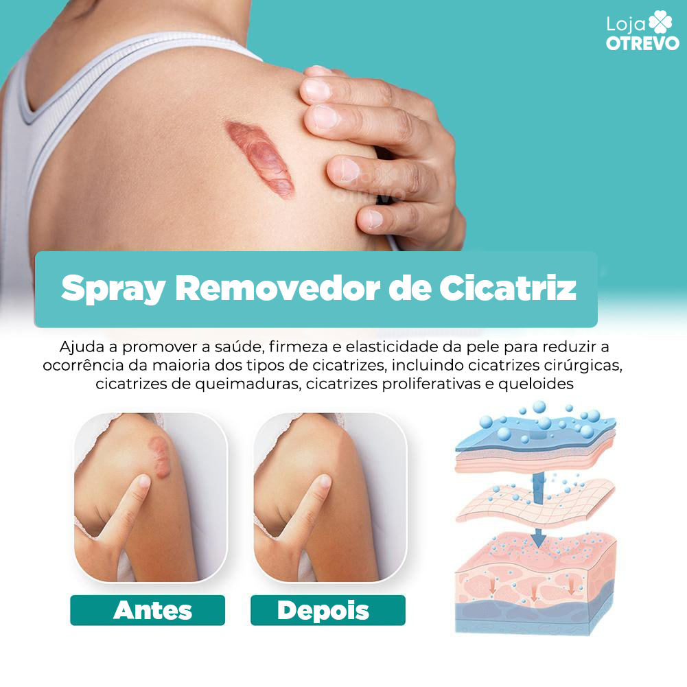 Spray Removedor Rápido de Cicatriz - ScarMax®