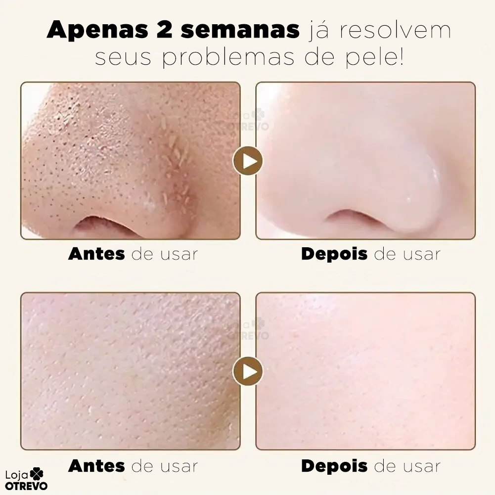 Gold Mask®  - Máscara Coreana Antienvelhecimento de Retinol Puro