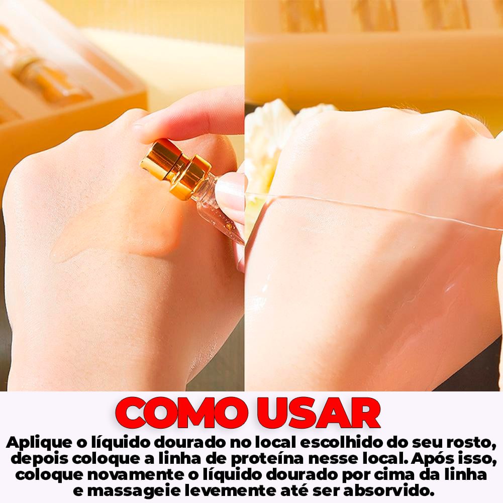 Kit Fios de Colágeno e Seda Removedores de Linhas de Expressão 40 PEÇAS -  ®LiftGold